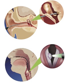 Gambar Idplaster ENT – Plaster Medikal Berkualiti Tinggi untuk Rawatan Telinga, Hidung & Tekak